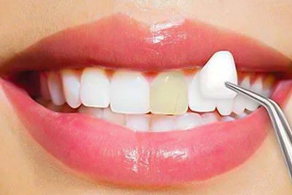 https://www.dentalspecialitycentre.co.in/wp-content/uploads/2025/05/Cosmetic-Dentistry.jpg