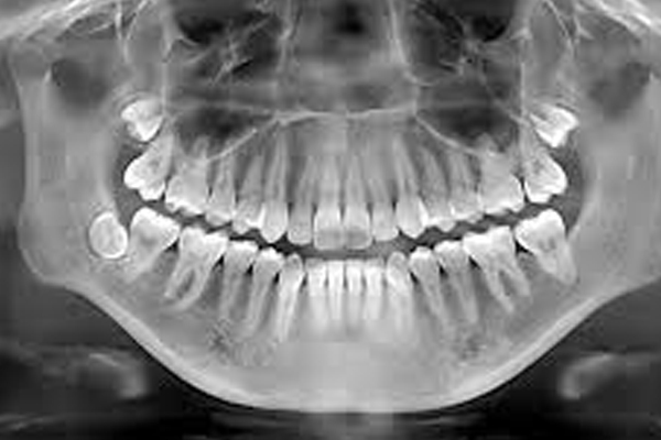 https://www.dentalspecialitycentre.co.in/wp-content/uploads/2025/05/Dental-X-Ray.jpg