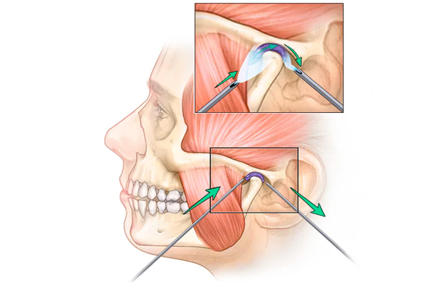 https://www.dentalspecialitycentre.co.in/wp-content/uploads/2025/05/tmj.jpg
